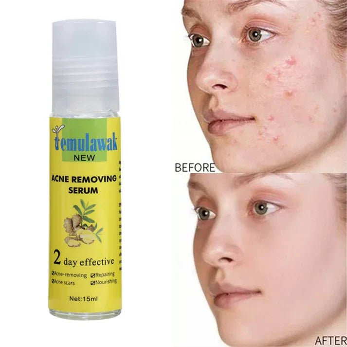 Temulawak - New Acne Removing Serum (Original)