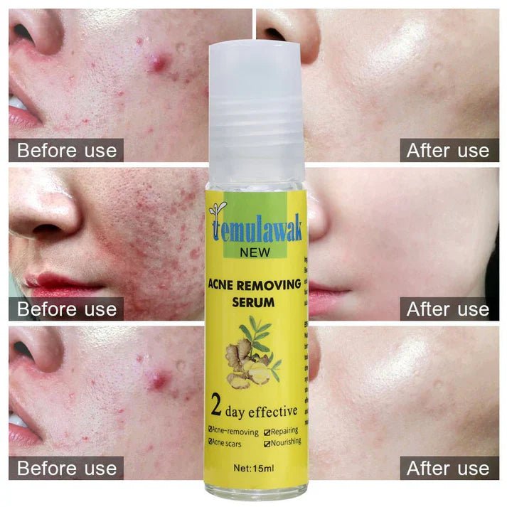 Temulawak - New Acne Removing Serum (Original) - Image 2