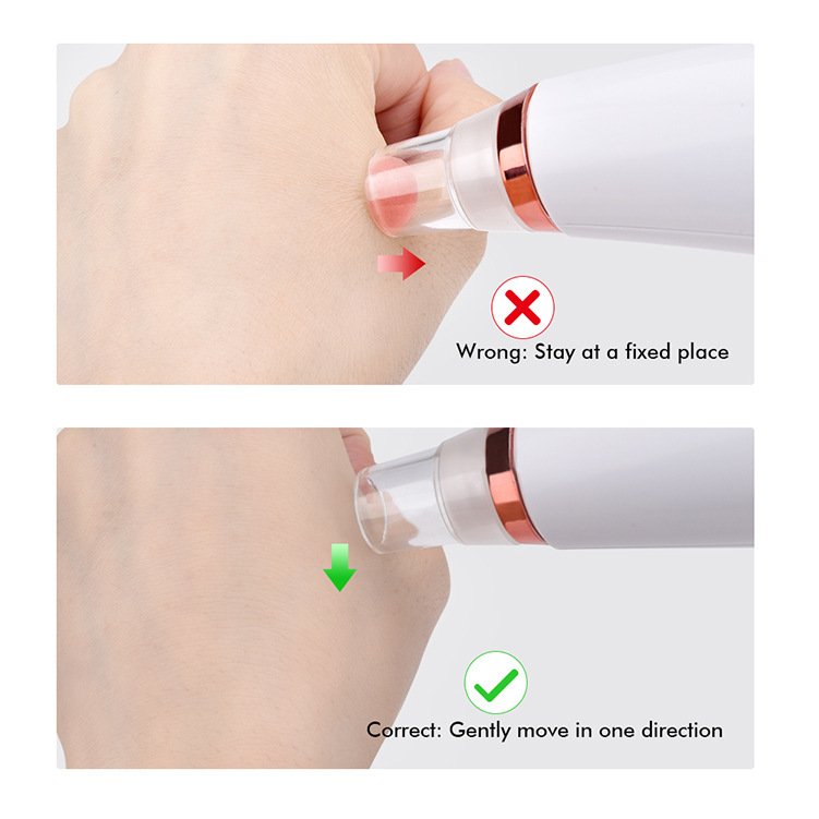 Top Selling Strong Acne Suction Mini Black Dots Point Pore Cleaner Vacuum for Home Use - Image 7